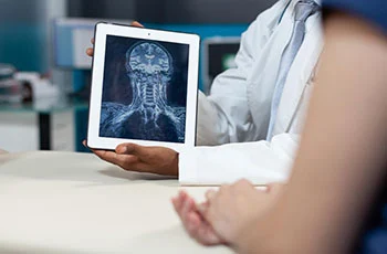 médico segurando tablet ilustrando aplicatico de raio-x